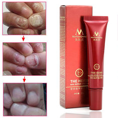 Toenail Fungus Treatment Cream Finger Toe Nail Fungus Onychomycosis Remover